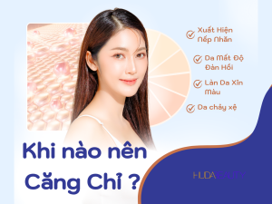 Khi nào nên căng chỉ