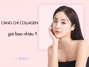Căng chỉ collagen giá bao nhiêu
