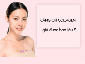 Căng chỉ collagen giữ đươc bao lâu