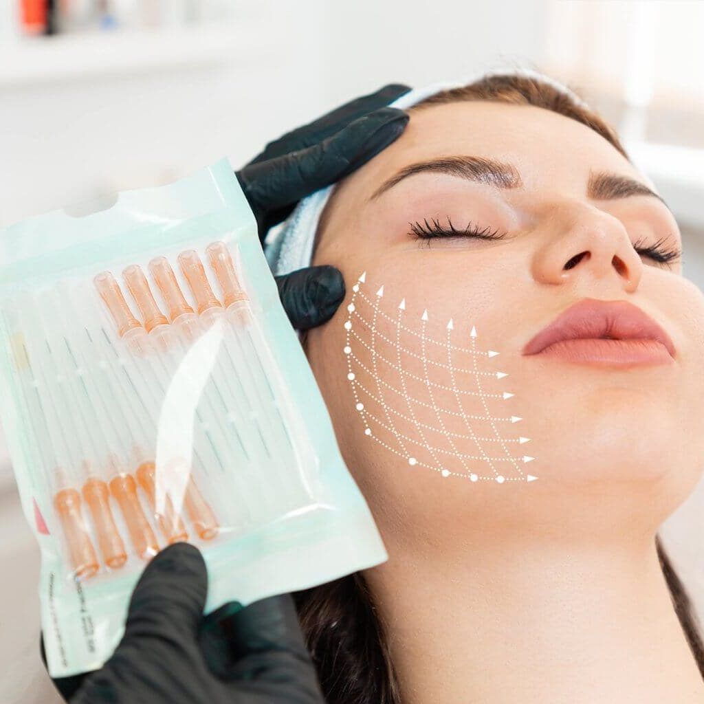 Căng Chỉ Khác Phẫu Thuật Nâng Cơ Như Thế Nào