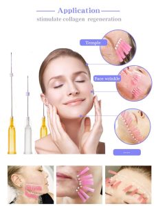 Căng chỉ da mặt có làm gương mặt kém tự nhiên không