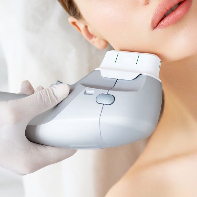 Căng chỉ da mặt vs HIFU