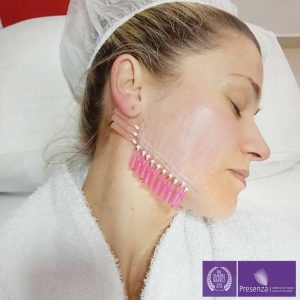 Những Ai Không Nên Căng Chỉ Da Mặt