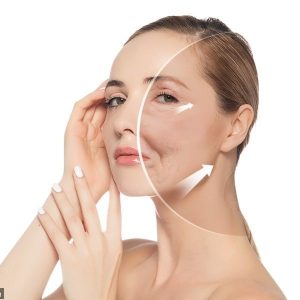 Sau Căng Chỉ Cần Nghỉ Dưỡng Bao Lâu