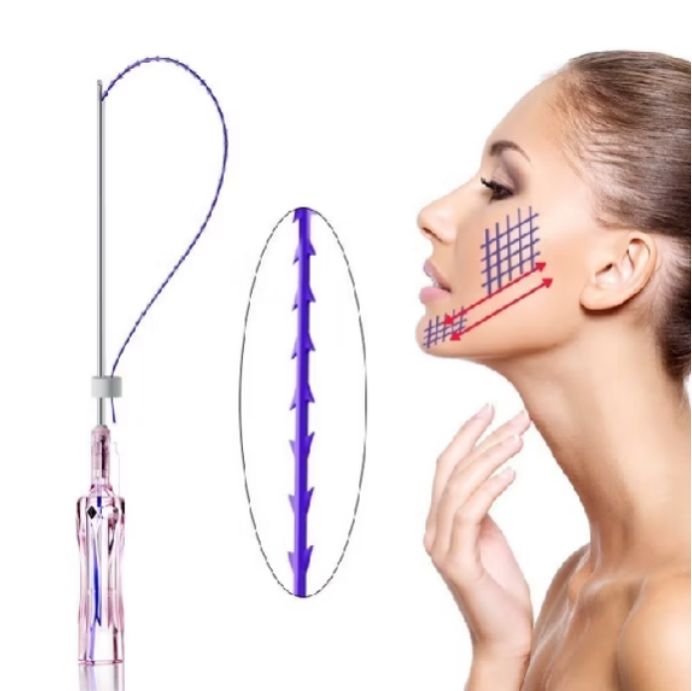 Căng Chỉ Collagen Có Phải Giải Pháp Tốt Nhất Cho Da Chảy Xệ?