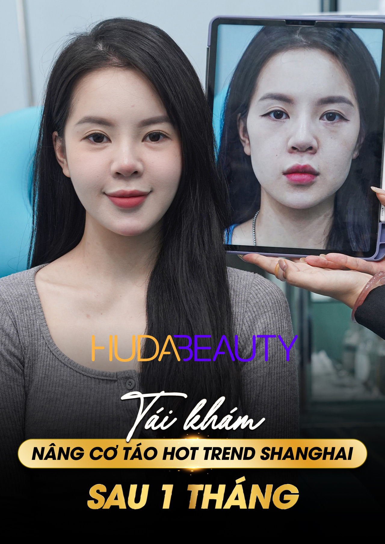  Căng Chỉ Da Mặt Có Đau Không