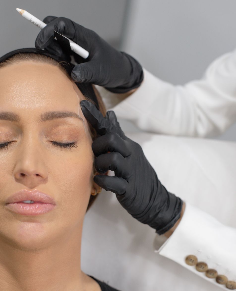 Filler và Cấy Mỡ Tự Thân