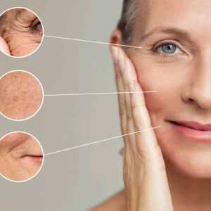 Nếp Nhăn, Da Chùng Nhão Xuất Hiện Khi Nào