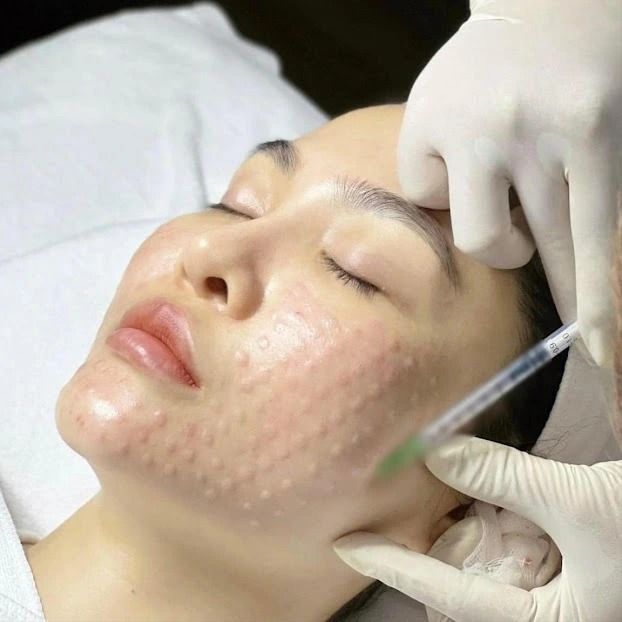 Top Phương Pháp Trẻ Hóa Da, Xóa Nhăn Được Ưa Chuộng Hiện Nay