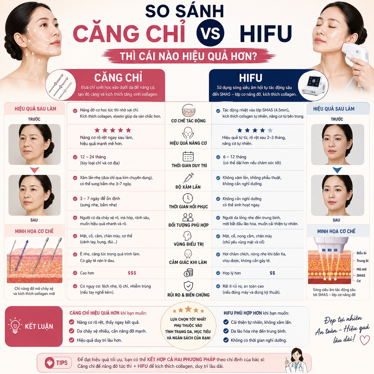 So Sánh Căng Chỉ Và HIFU - Phương Pháp Nào Hiệu Quả Hơn