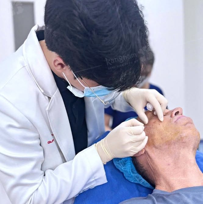 Căng Chỉ Có Giúp Xóa Nọng Cằm Không