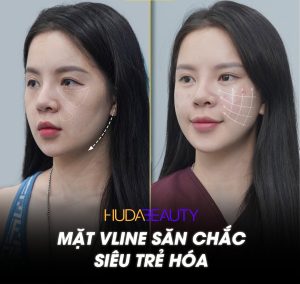 Chỉ PDO hay PCL tốt hơn