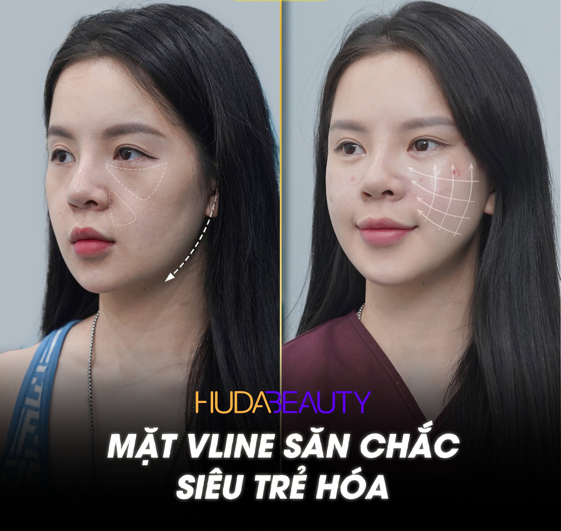 Chỉ PDO hay PCL tốt hơn
