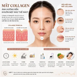 Mất Collagen Ảnh Hưởng Đến Khuôn Mặt Như Thế Nào?